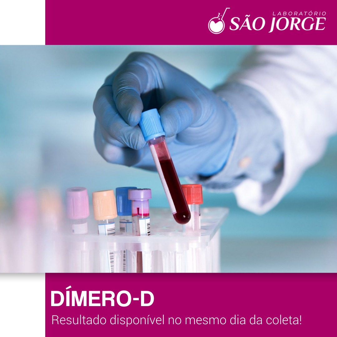 DÍMERO -D: Saiba mais sobre esse exame tão pedido em pacientes com Covid-19! - Laboratório São Jorge