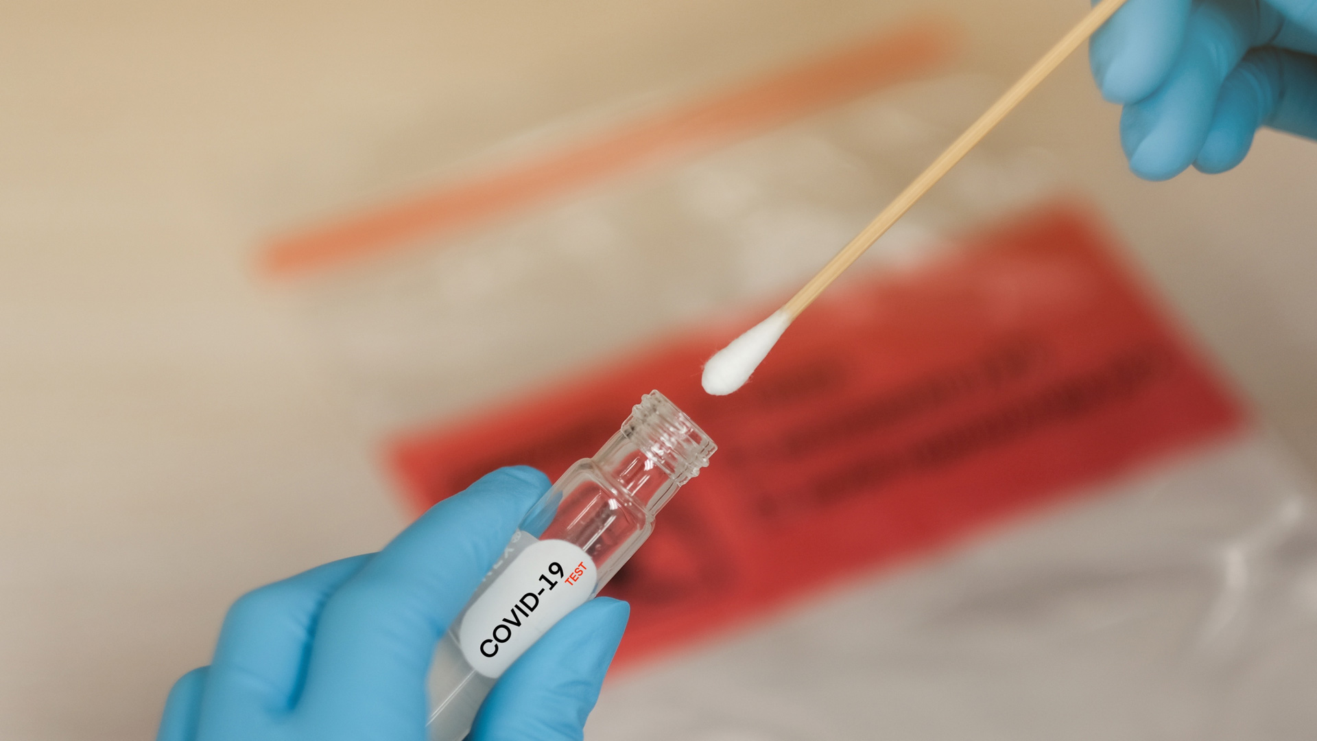 O Diagnóstico da Covid-19 através de testes laboratoriais - Laboratório São Jorge